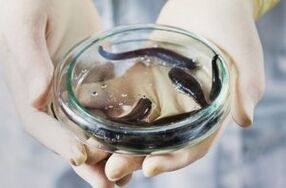 Treatment of varicose veins with water ches
