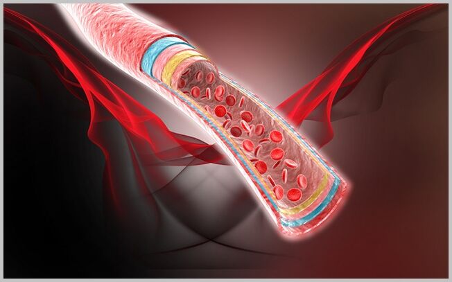 Treating venous blood flow after varicose veins with gel