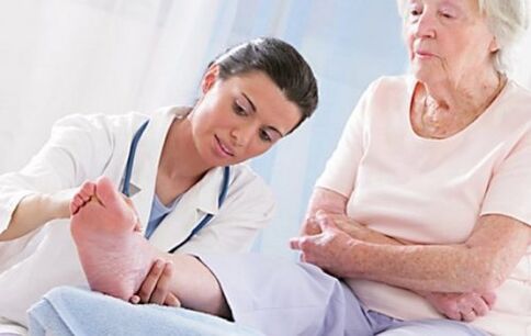 If you have symptoms of varicose veins, see your doctor